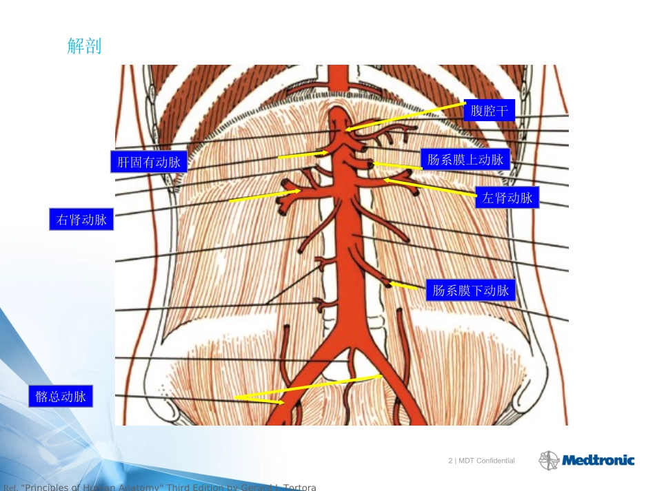 腹主动脉解剖及病理_第2页