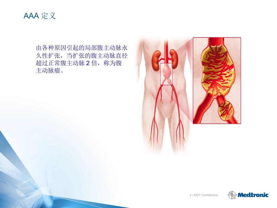腹主动脉解剖及病理_第3页