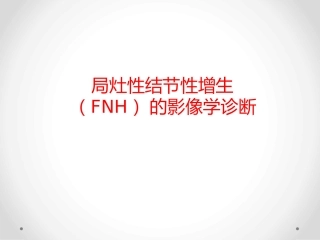 肝局灶性结节增生影像表现