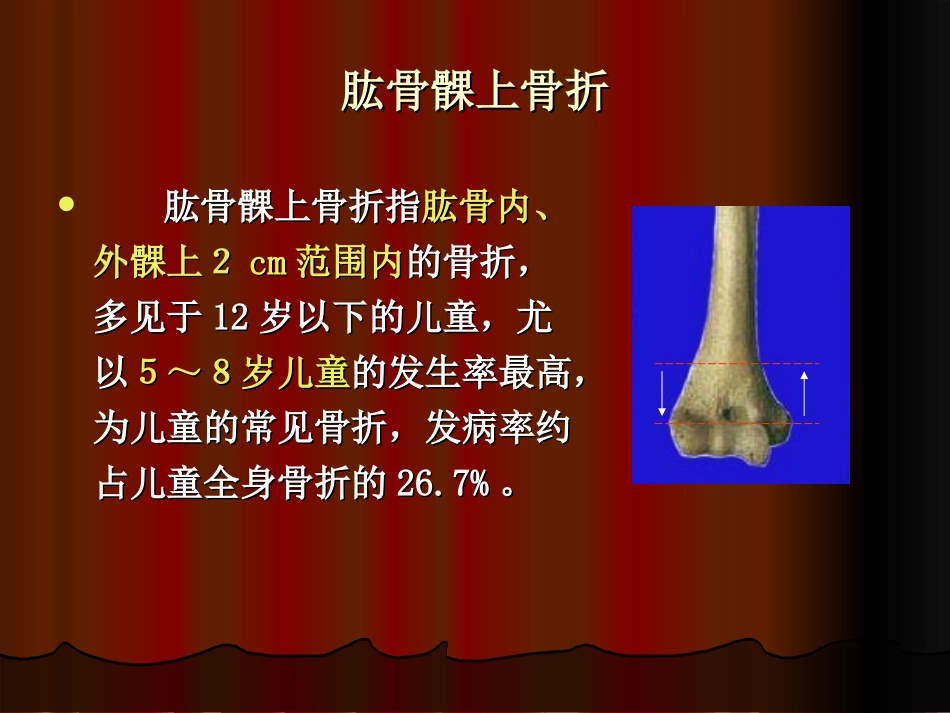 肱骨髁上骨折_第1页