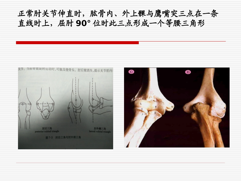 肱骨远端骨折_第3页