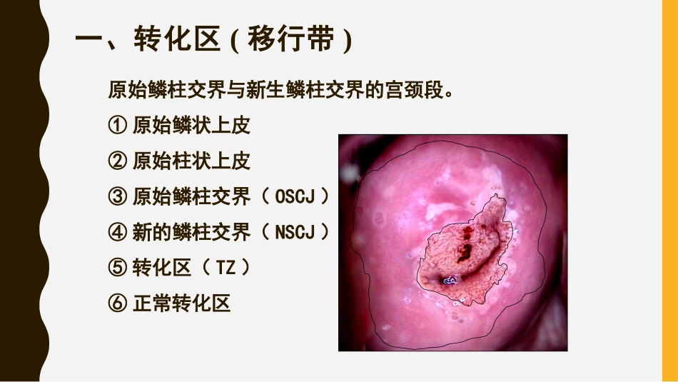 宫颈癌筛查文献汇报HPV和TCT_第2页