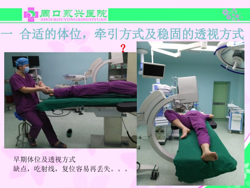 股骨近端骨折的几个感悟好_第2页