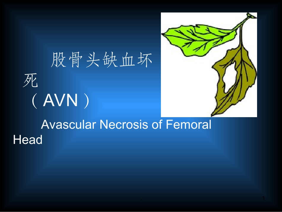 股骨头缺血坏死课件_第1页