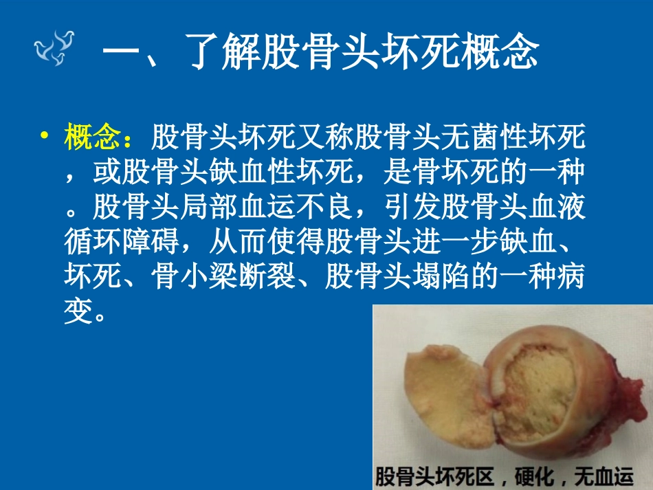 股骨头钻孔及植骨术_第3页