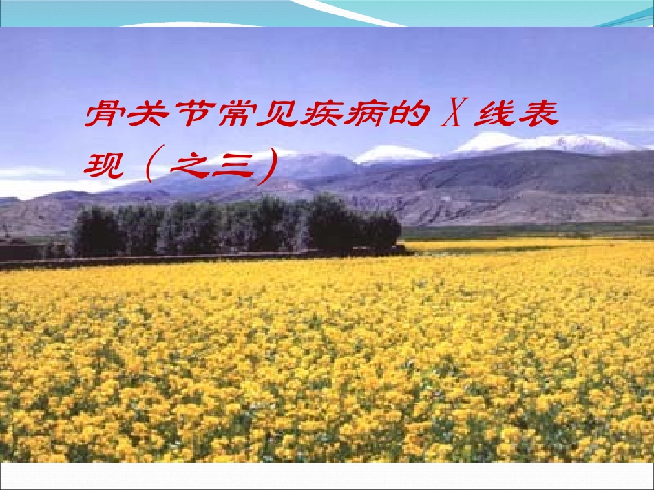 骨结核和肿瘤_第1页
