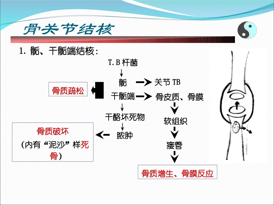 骨结核和肿瘤_第3页