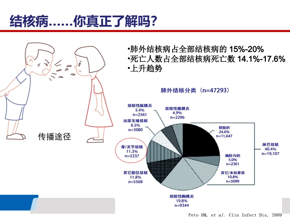 骨科结核感染T细胞斑点检测SPOT_第2页