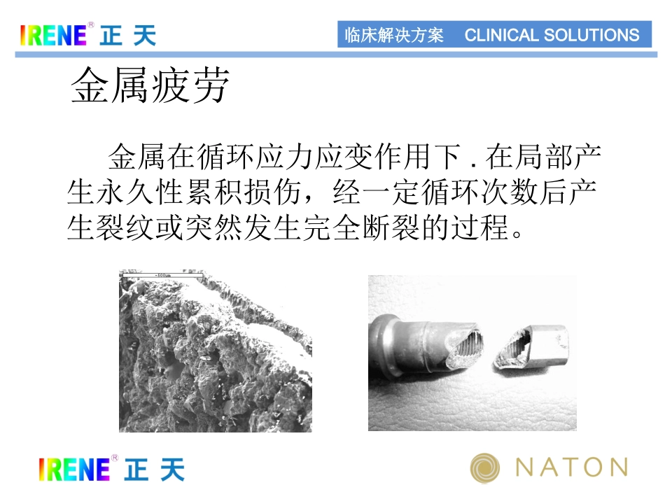 骨科医生的难题内固定断裂_第3页