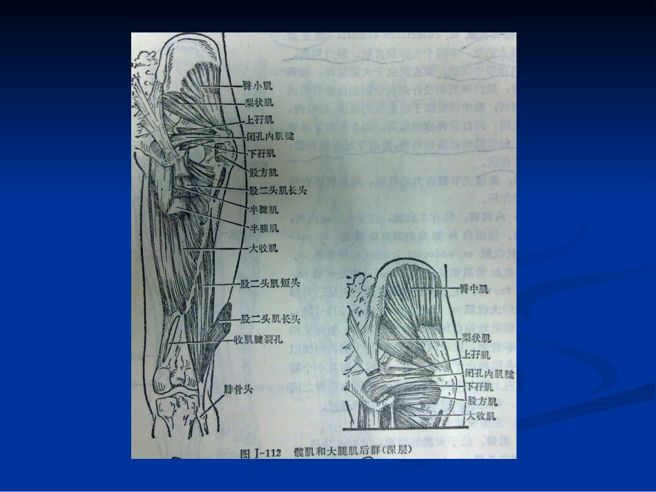 骨盆肌肉MRI解剖讲义_第2页