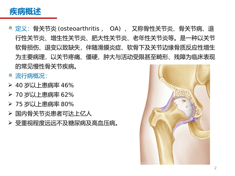 骨性关节炎的康复_第2页