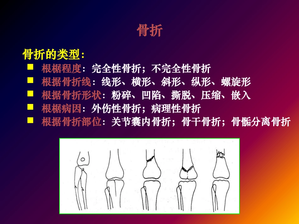 骨折影像诊疗_第3页