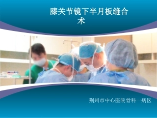 关节镜下半月板缝合术
