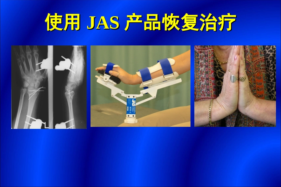 关节康复治疗方法_第1页