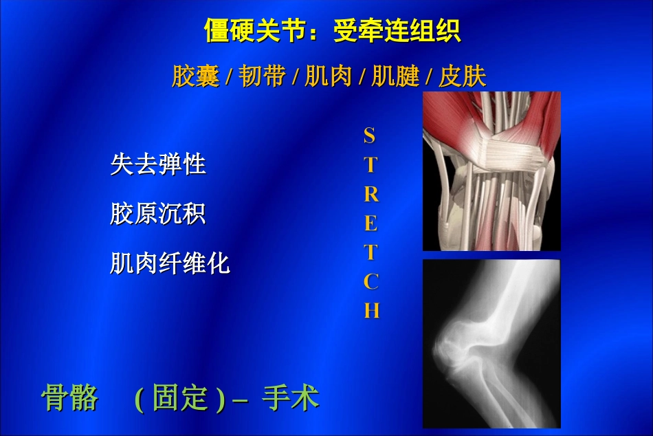 关节康复治疗方法_第3页