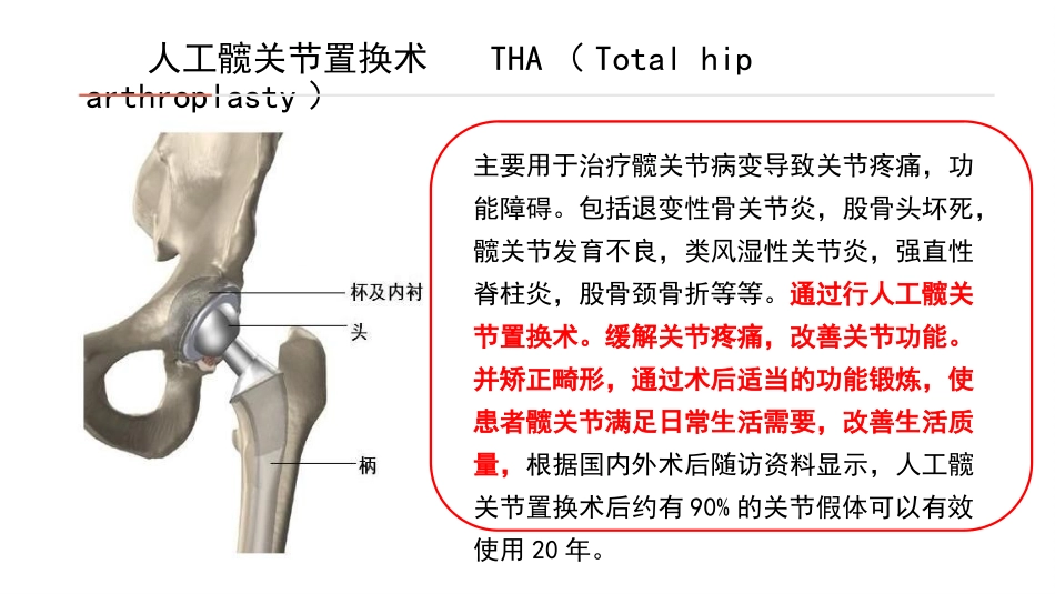 关节外科教学查房_第3页