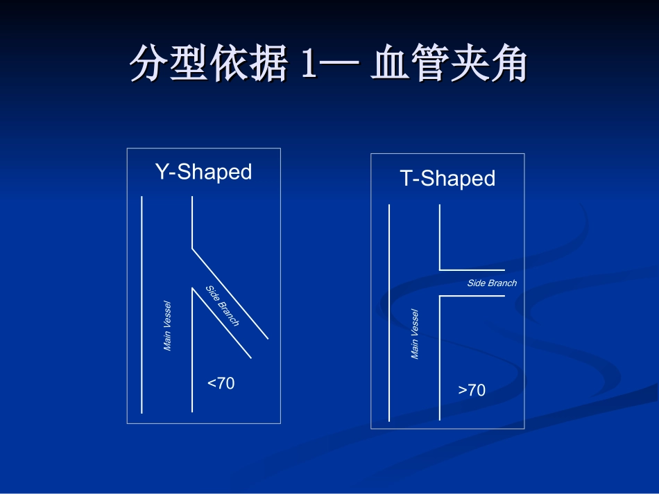 冠脉分叉病变术式_第3页