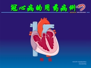 冠心病用药病例介绍