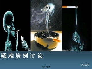 喉癌疑难病例讨论课件