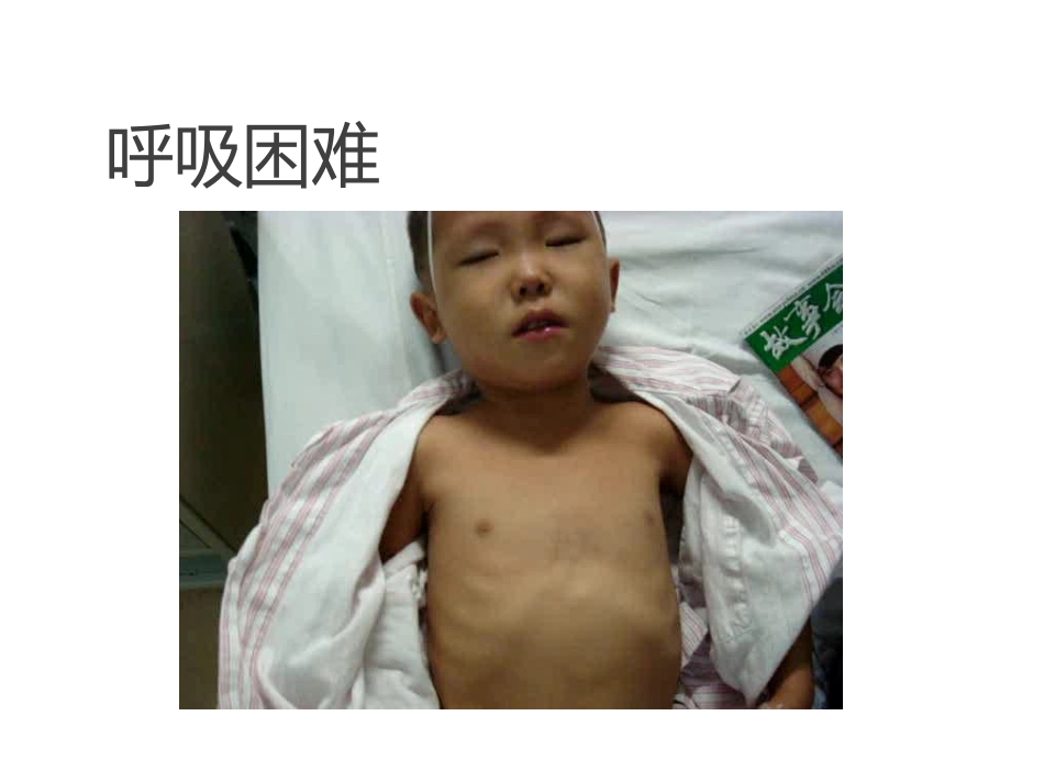 喉梗阻气管切开本科_第3页