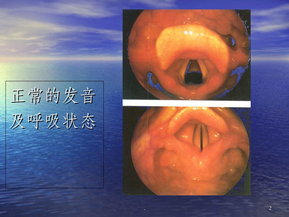 喉阻塞病人护理_第2页