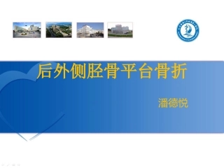 后外侧胫骨平台骨折