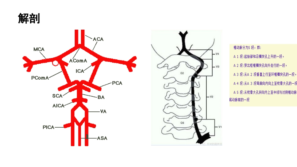 后循环卒中姚恺_第3页