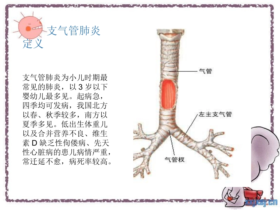 护理查房小儿支气管肺炎整理版_第2页