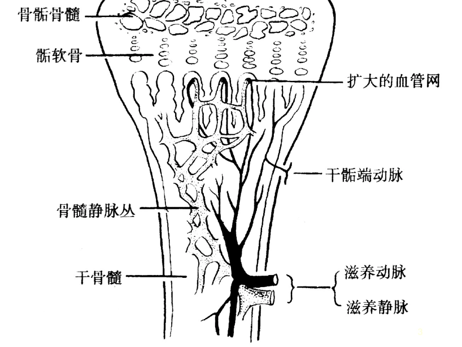 化脓性骨髓炎医学课件_第3页