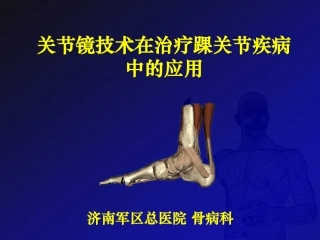 踝关节镜技术在治疗踝关节疾病中的应用课件