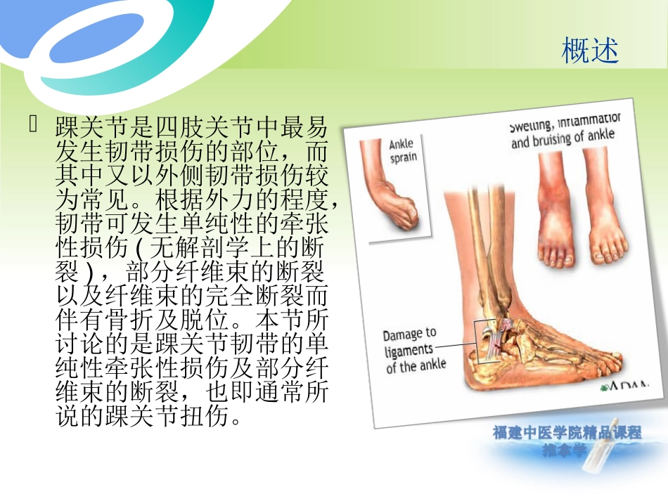 踝关节扭伤精_第2页