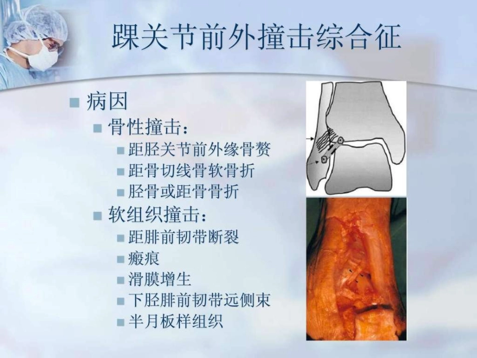 踝关节撞击综合征_第3页