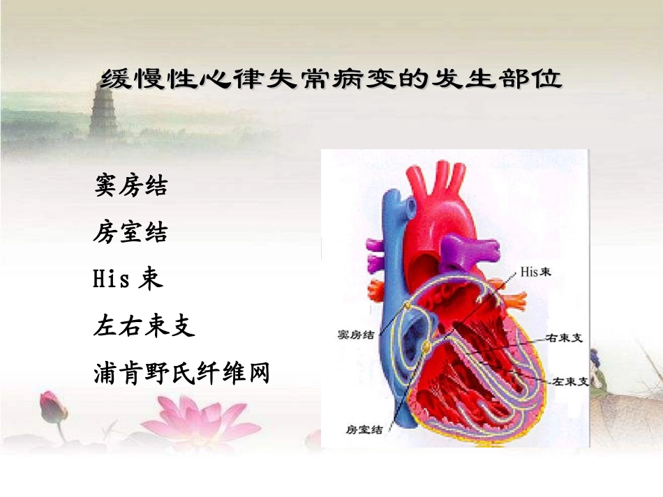 缓慢性心律失常的诊疗及治疗_第3页