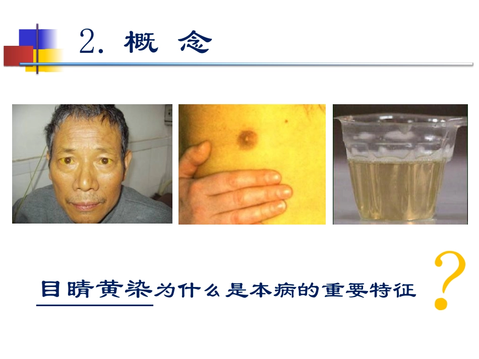 黄疸的中医标准化治疗完整版_第3页