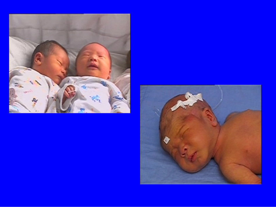 黄疸中医精髓_第2页