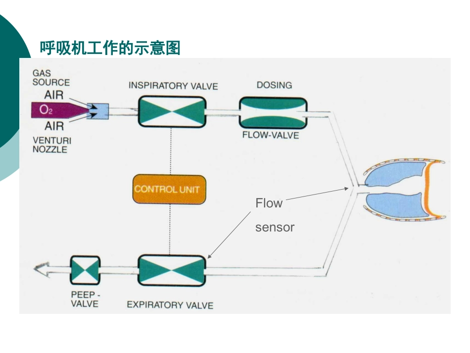 机械通气波形分析分析_第2页