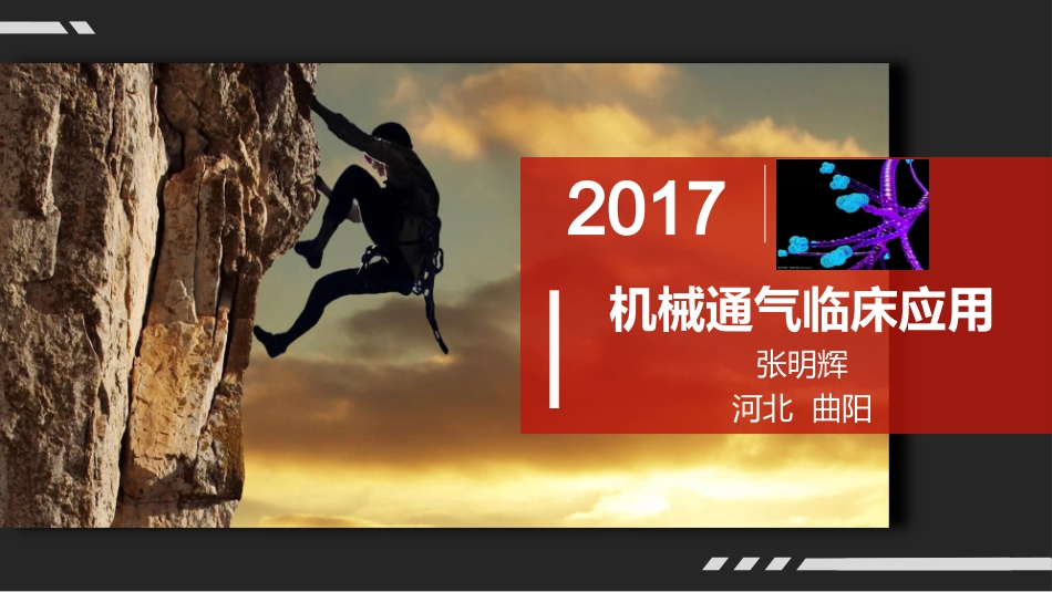 机械通气的临床应用_第1页