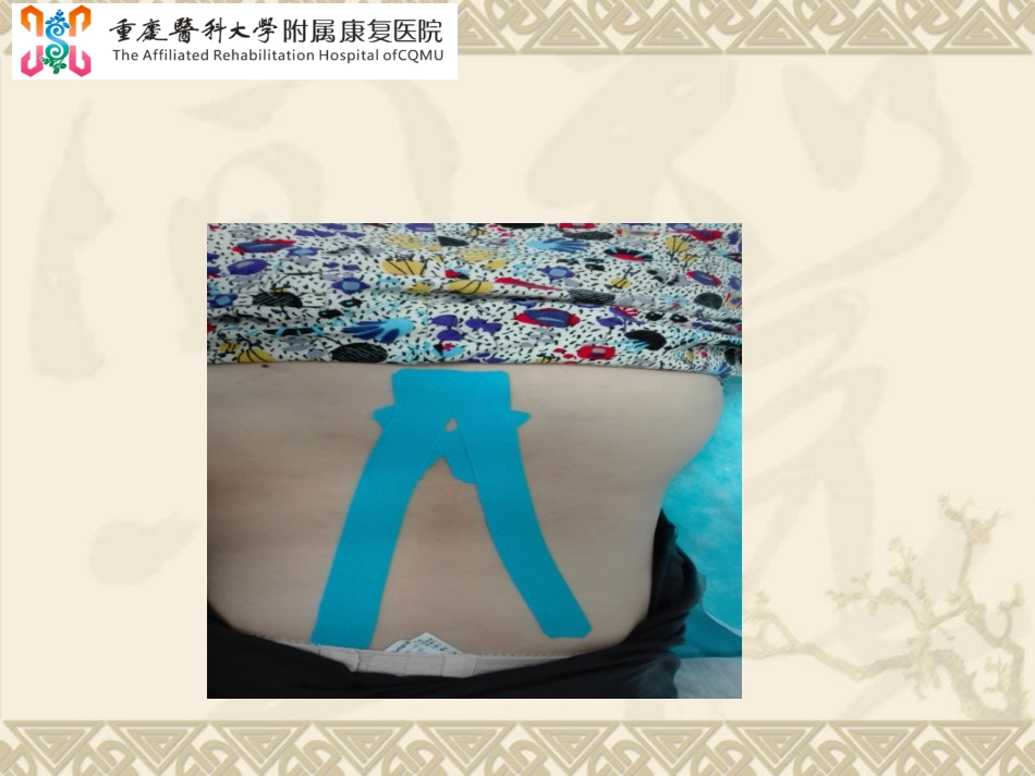 肌内效贴布法模板_第2页