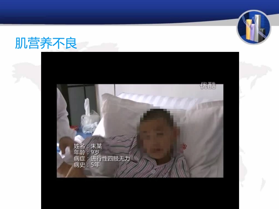 肌营养不良症_第2页