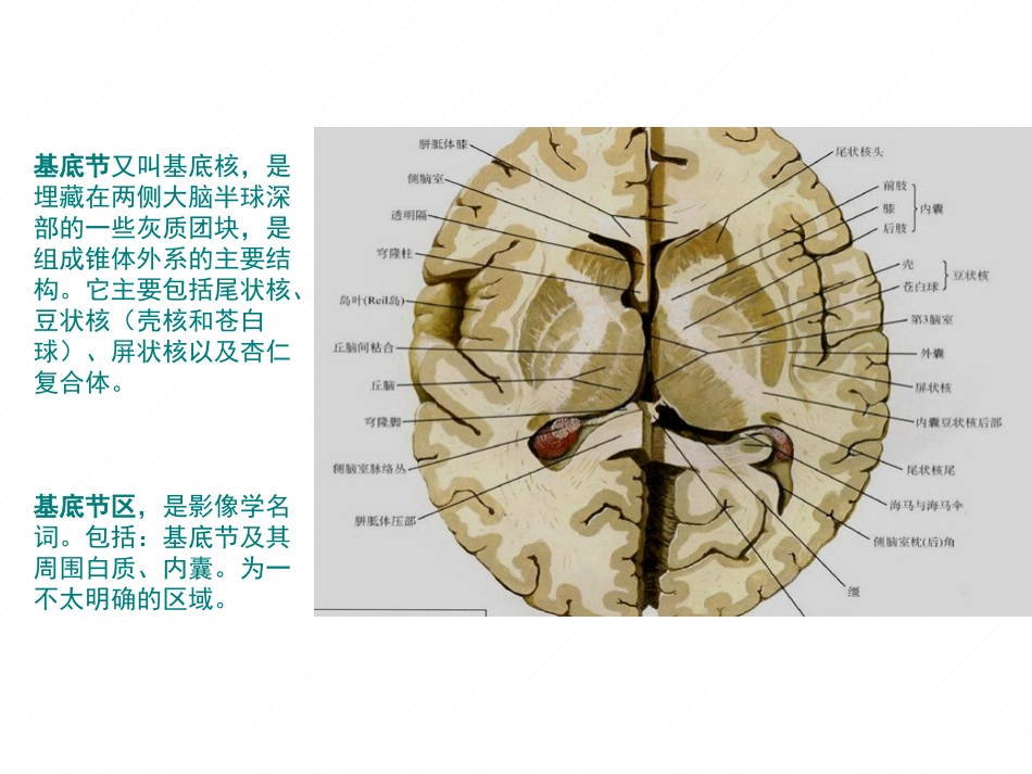 基底节区对称性病变的病因和影像学特征_第2页