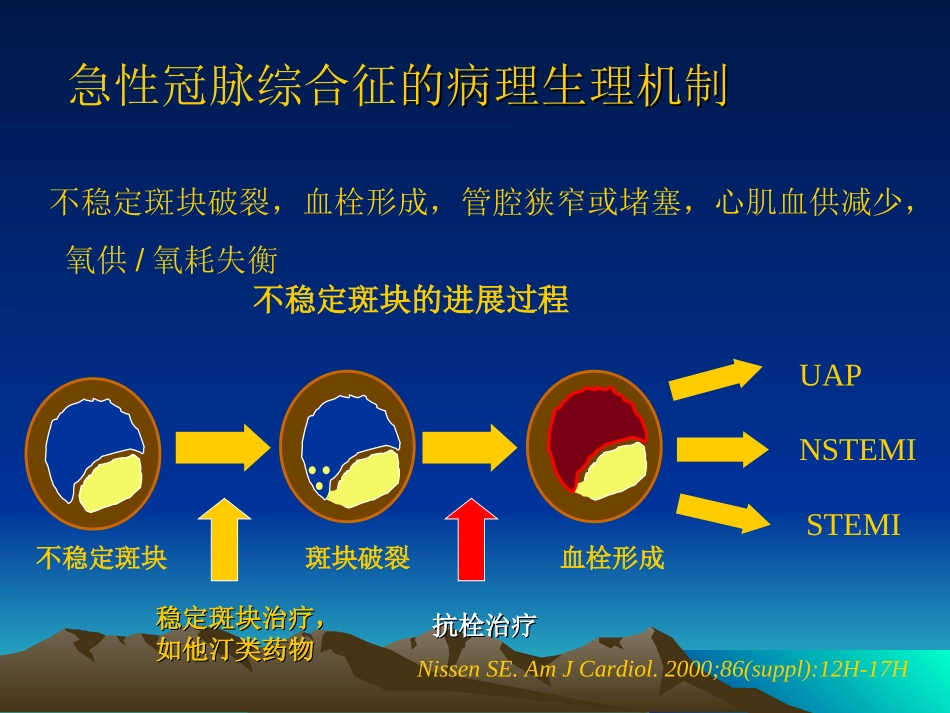 急性冠脉综合征的抗栓治疗课件_第3页