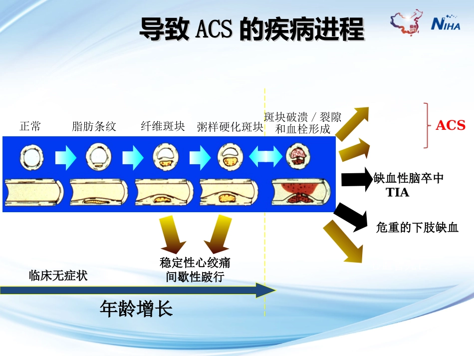 急性冠脉综合征讲义_第3页
