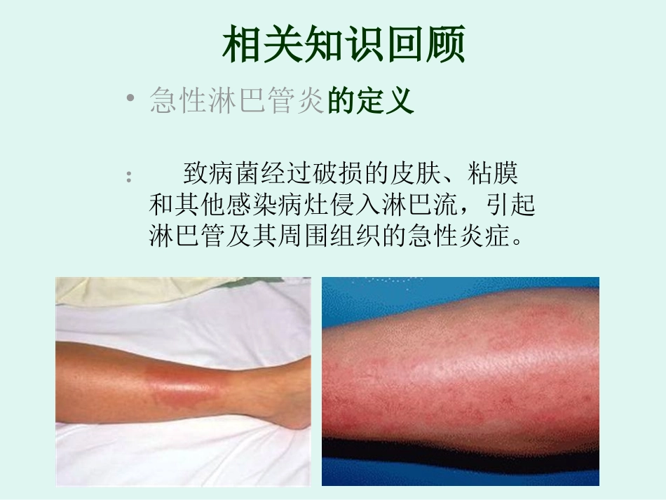 急性淋巴管炎的护理查房_第3页