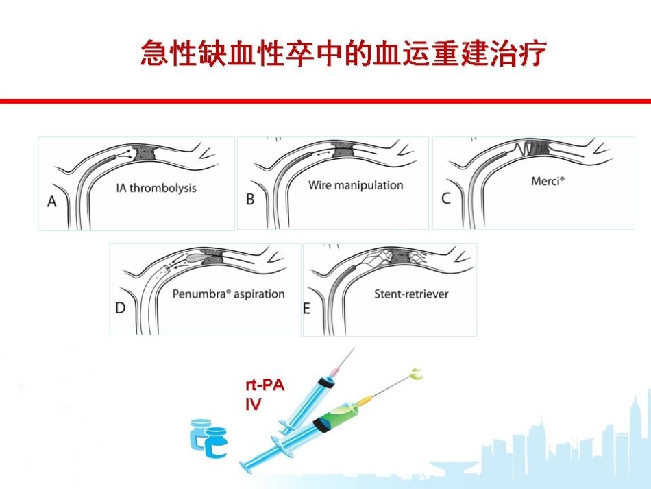 急性缺血性缺血性卒中急性期血管内治疗_第2页