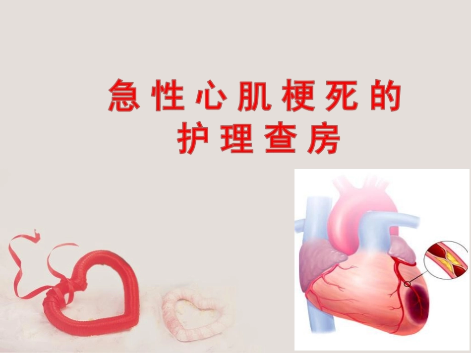 急性心肌梗死的护理查房_第1页