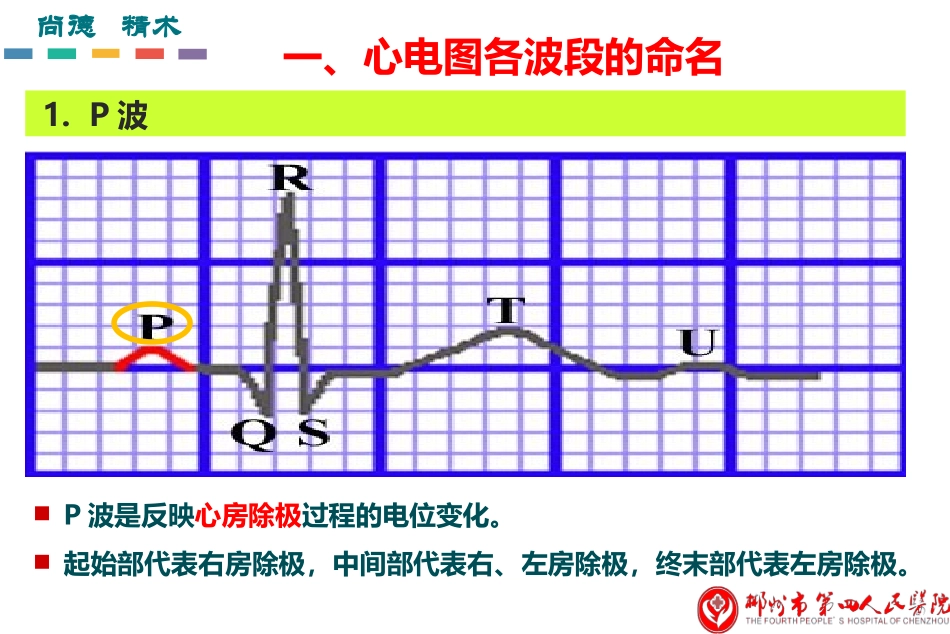 急性心肌梗死的心电图诊疗科室简要_第3页