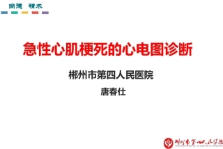 急性心肌梗死的心电图诊疗科室简要