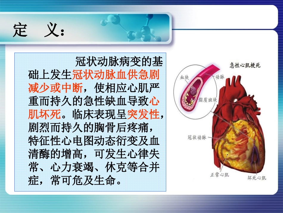 急性心肌梗死抢救康哲_第2页