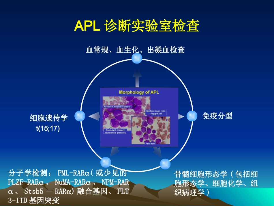 急性早幼粒细胞白血病_第2页