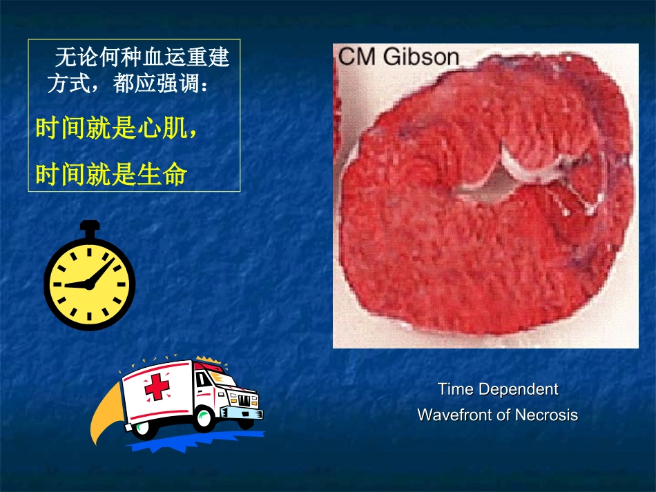 急诊PCI治疗要点指导建议_第3页